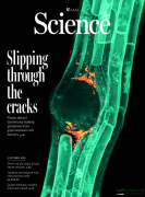 “Localized glutamine leakage drives the spatial structure o